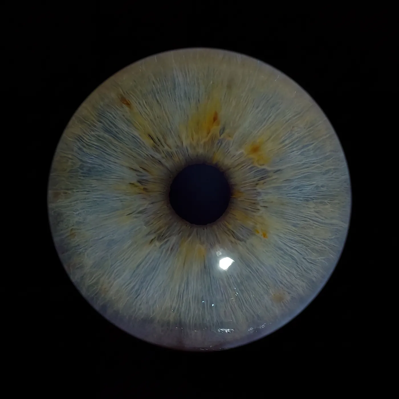 Blaugraue Iris mit gelblichen Pigmenten