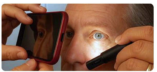 Irisfoto mit Smartphone und seitlicher Beleuchtung